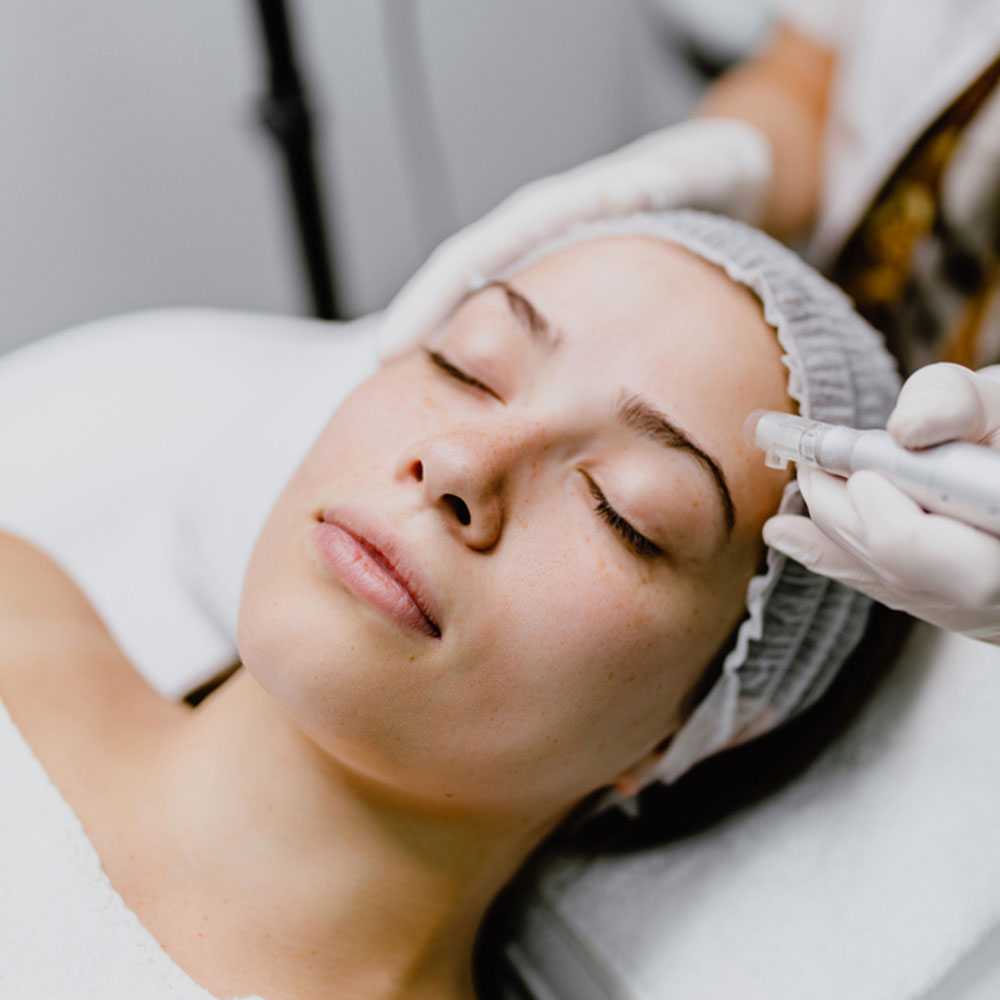 Microdermabrasion & Dermaplaning | Des Moines, IA | Hush  - Microneedling-1