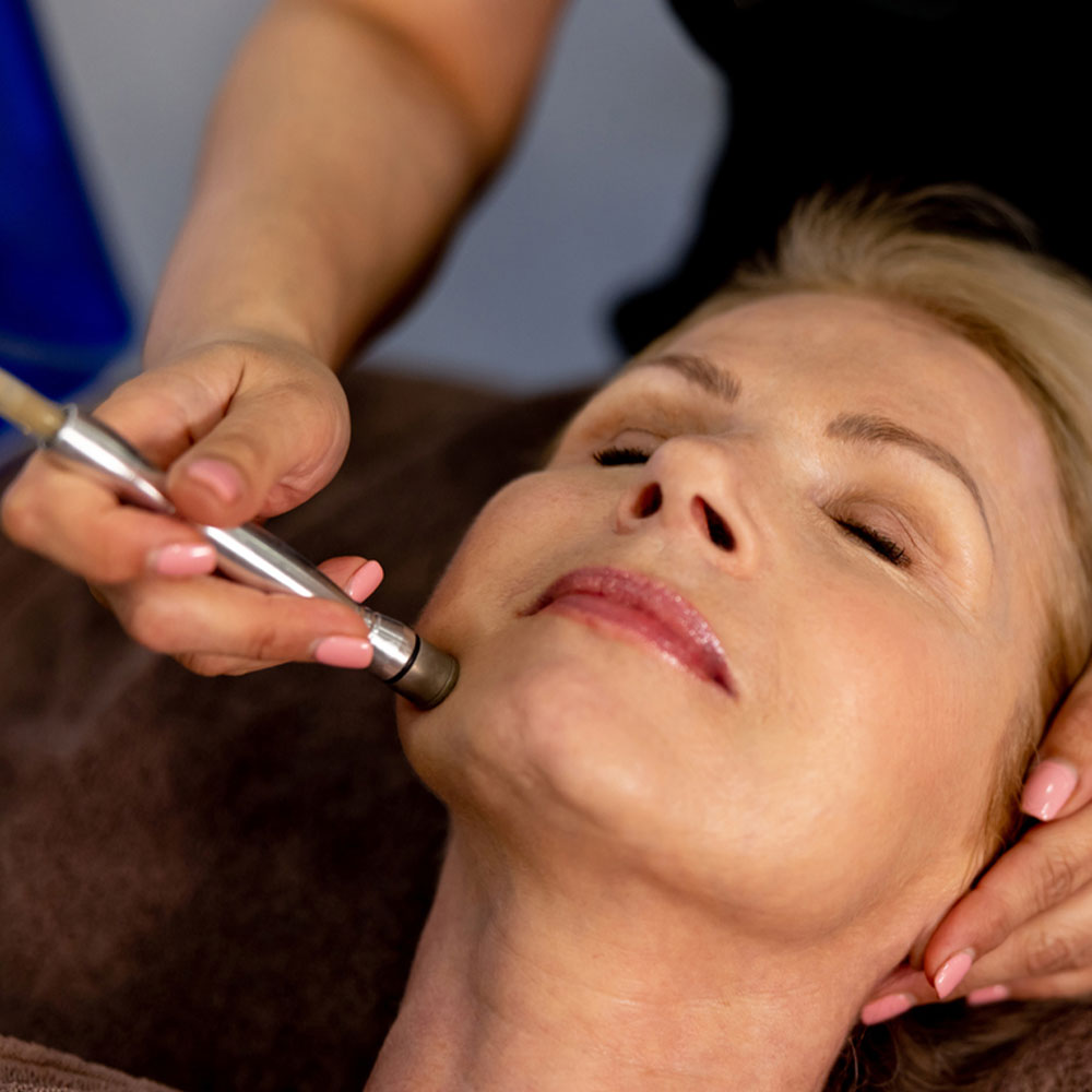 Microdermabrasion & Dermaplaning | Des Moines, IA | Hush  - microneedling-3